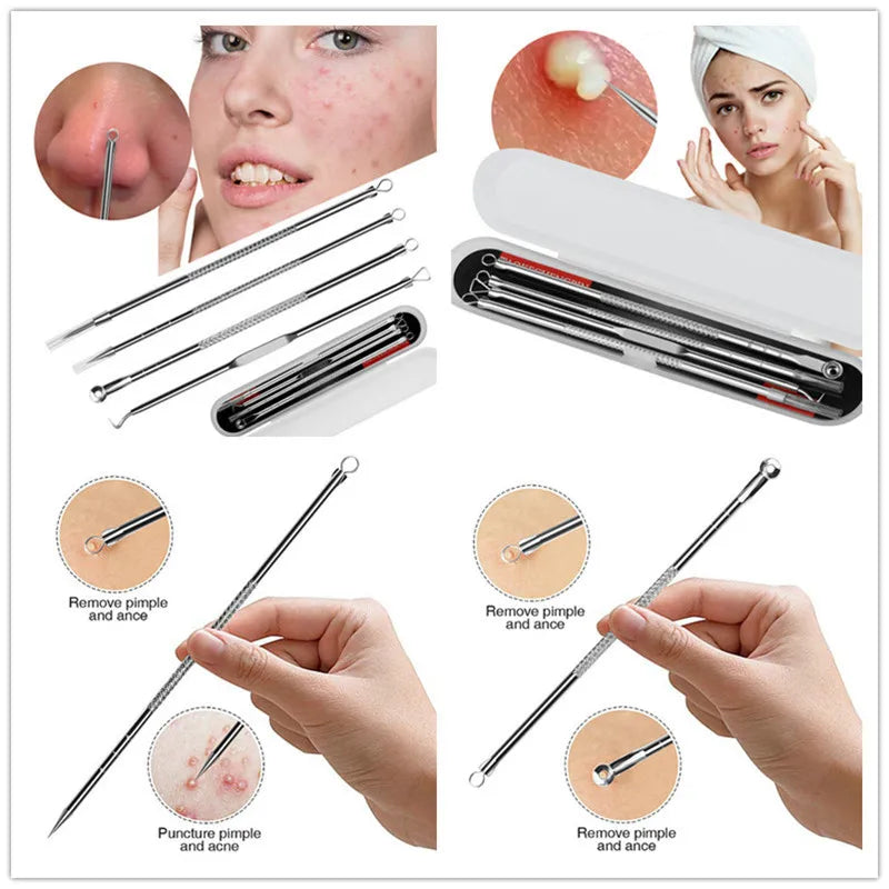 4Pcs Blackhead and Acne Remover Set double-ended loop application closeup for effective black spot removal