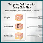 8-Piece Stainless Steel Acne & Blackhead Removal Tool Set various needle loop tips diagram for targeted pore cleaning