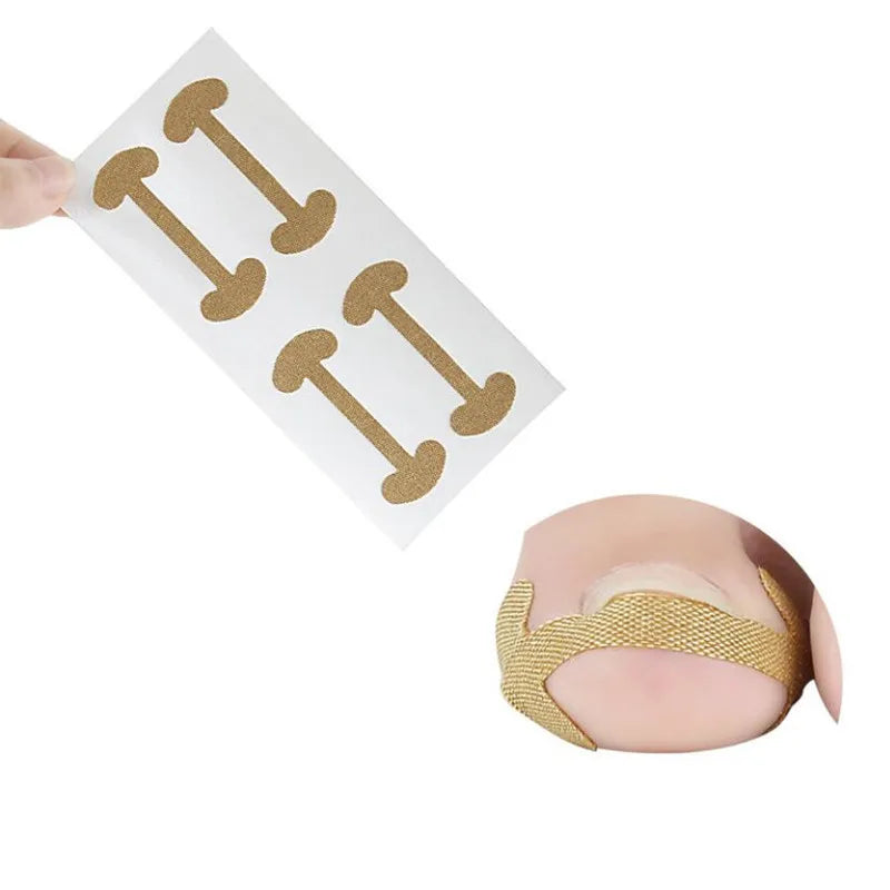 Toenail Corrector Stickers Foot Care Tool