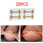Toenail Corrector Stickers Foot Care Tool