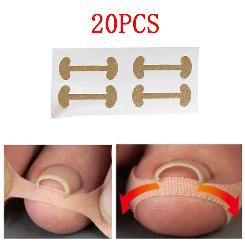 Toenail Corrector Stickers Foot Care Tool