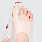 Big Toe Bunion Corrector Foot Care Support