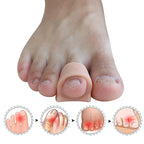 Hammertoe Corrector Toe Support Splint