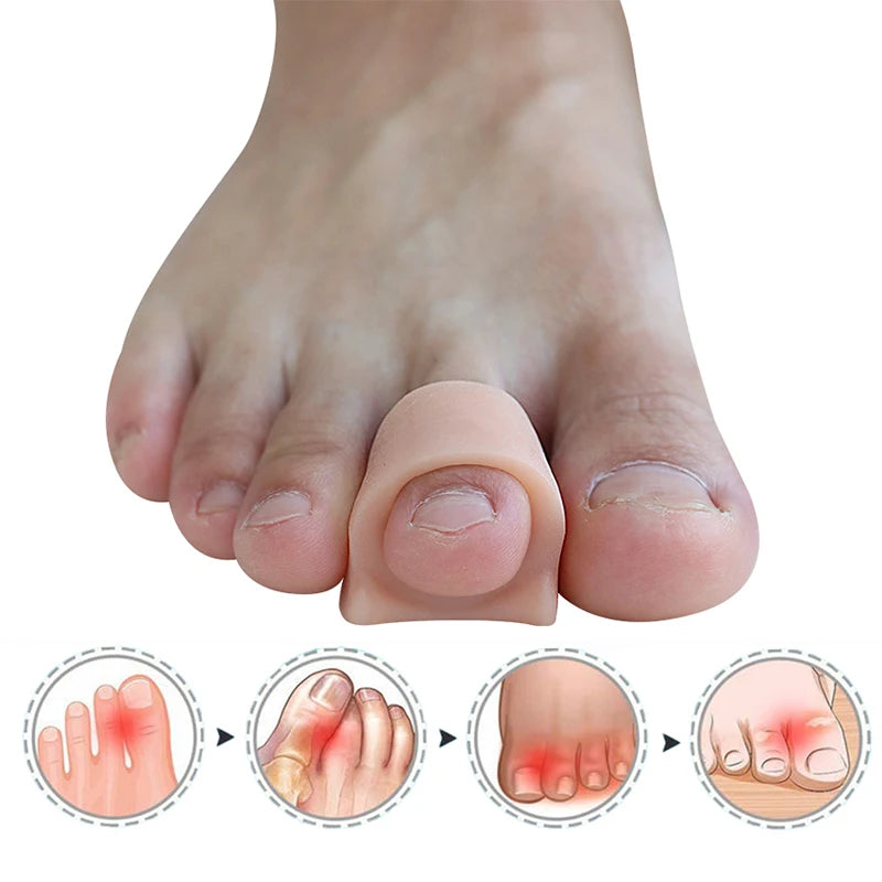 Hammertoe Corrector Toe Support Splint