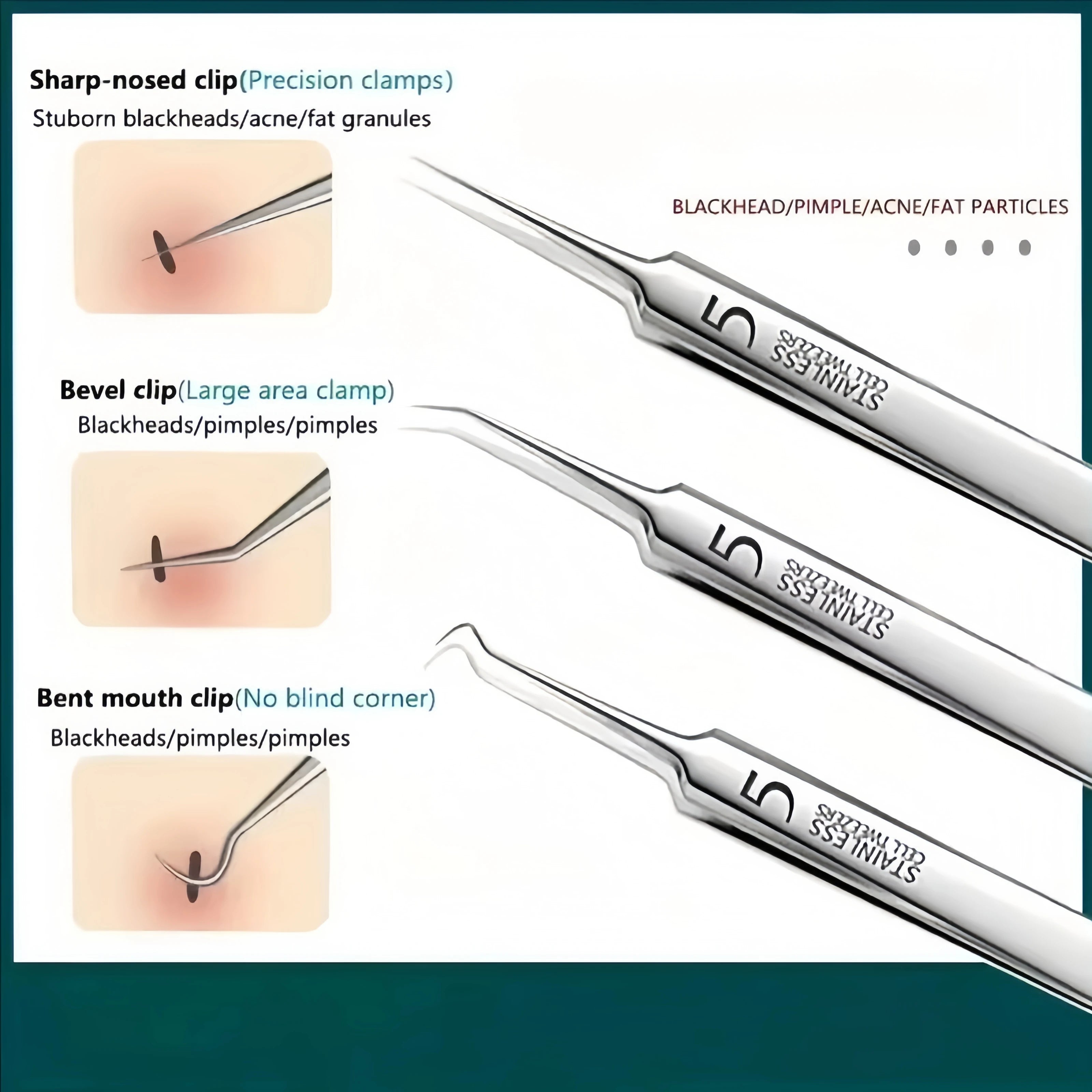 8Pcs Stainless Steel Acne Blackhead Clip Set Facial Pore Cleaner Tool