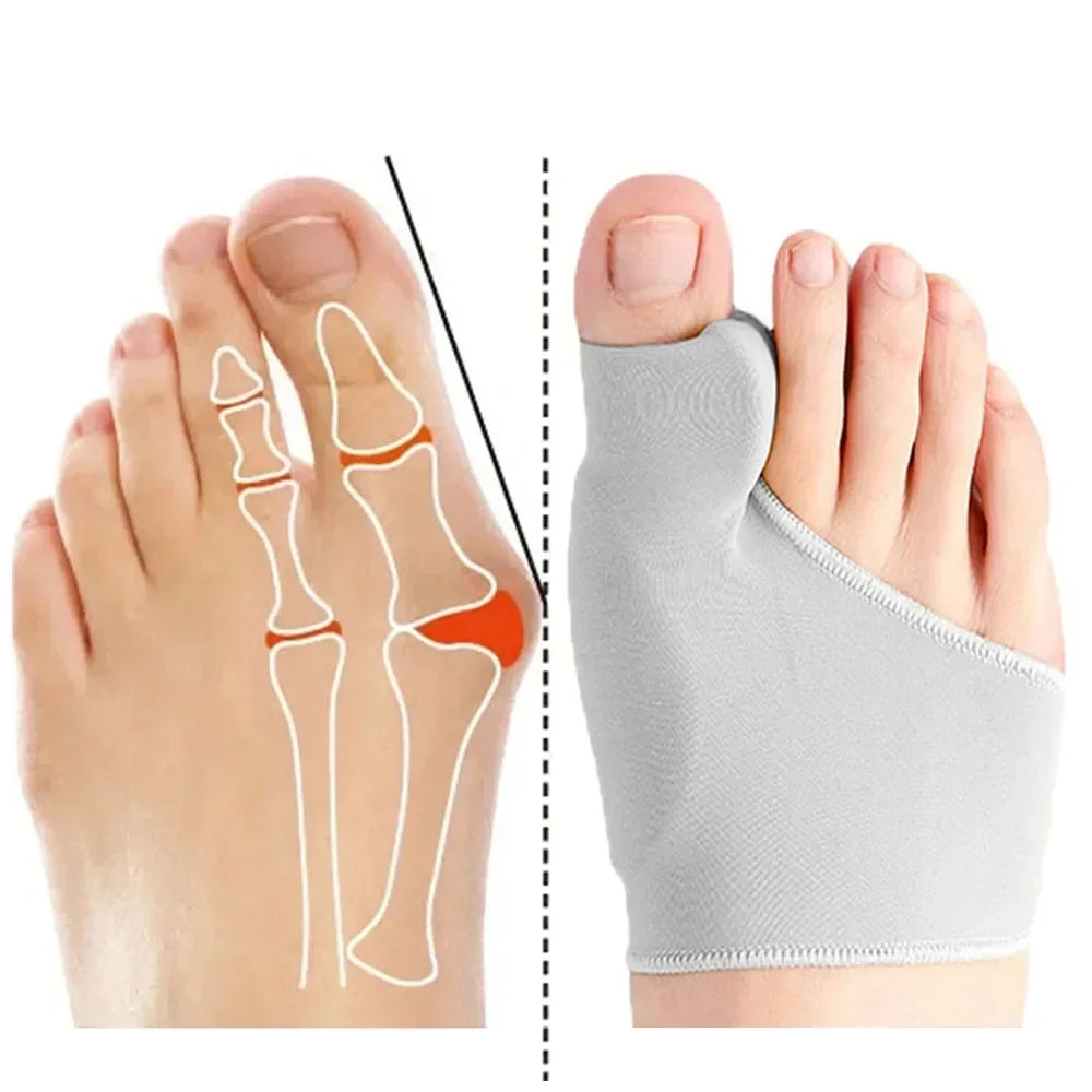 Bunion Corrector Toe Separator Support