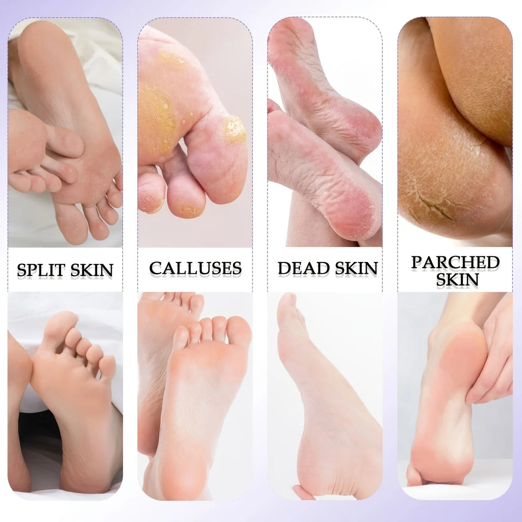 8-in-1 Pedicure Kit Foot Care Tools