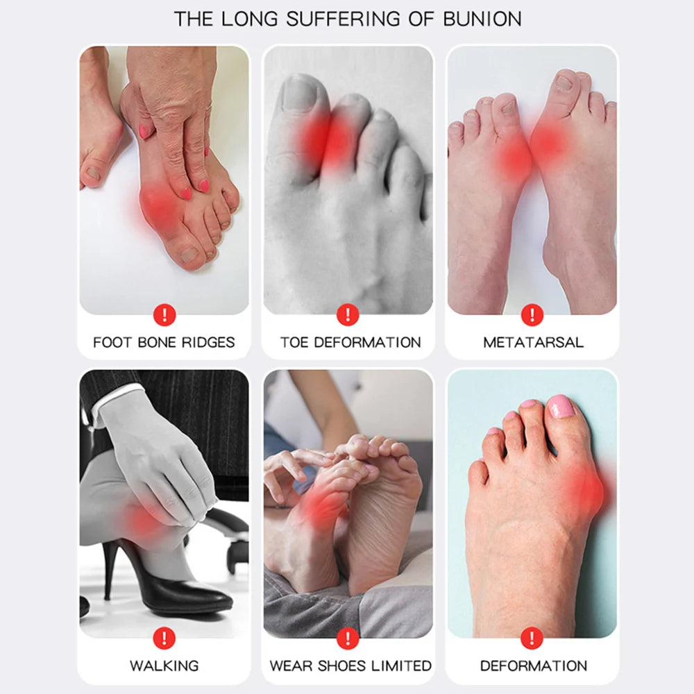 Big Toe Bunion Corrector Foot Care Support
