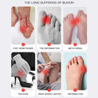 Big Toe Bunion Corrector Foot Care Support