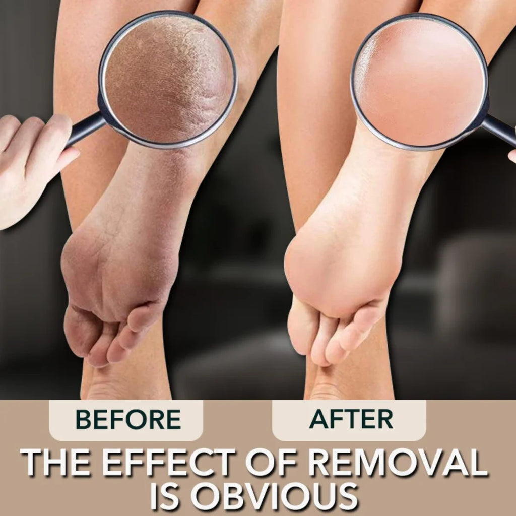 Nano Glass Foot Rasp Callus Remover Tool