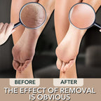 Nano Glass Foot Rasp Callus Remover Tool