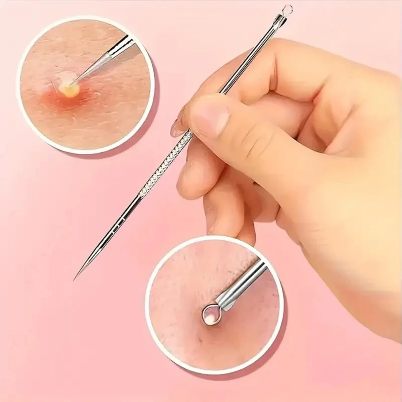 Stainless Steel Blackhead Remover Tool – Acne Pore Extractor Needle