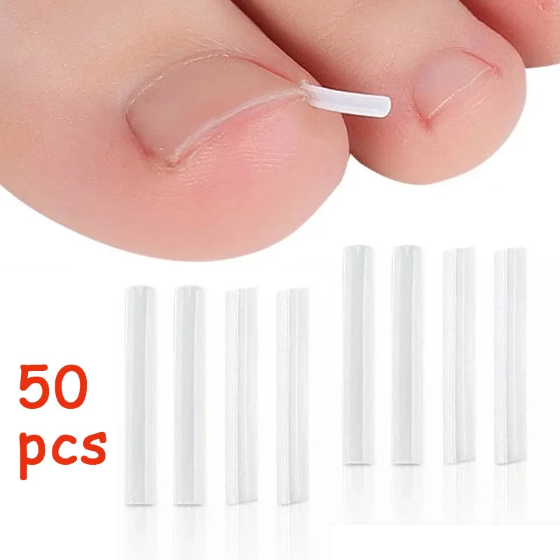 Ingrown Toenail Correction Tool Foot Care