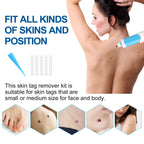 Skin Tag Remover 1-4mm Painless Safe Home Use Face Skin Care