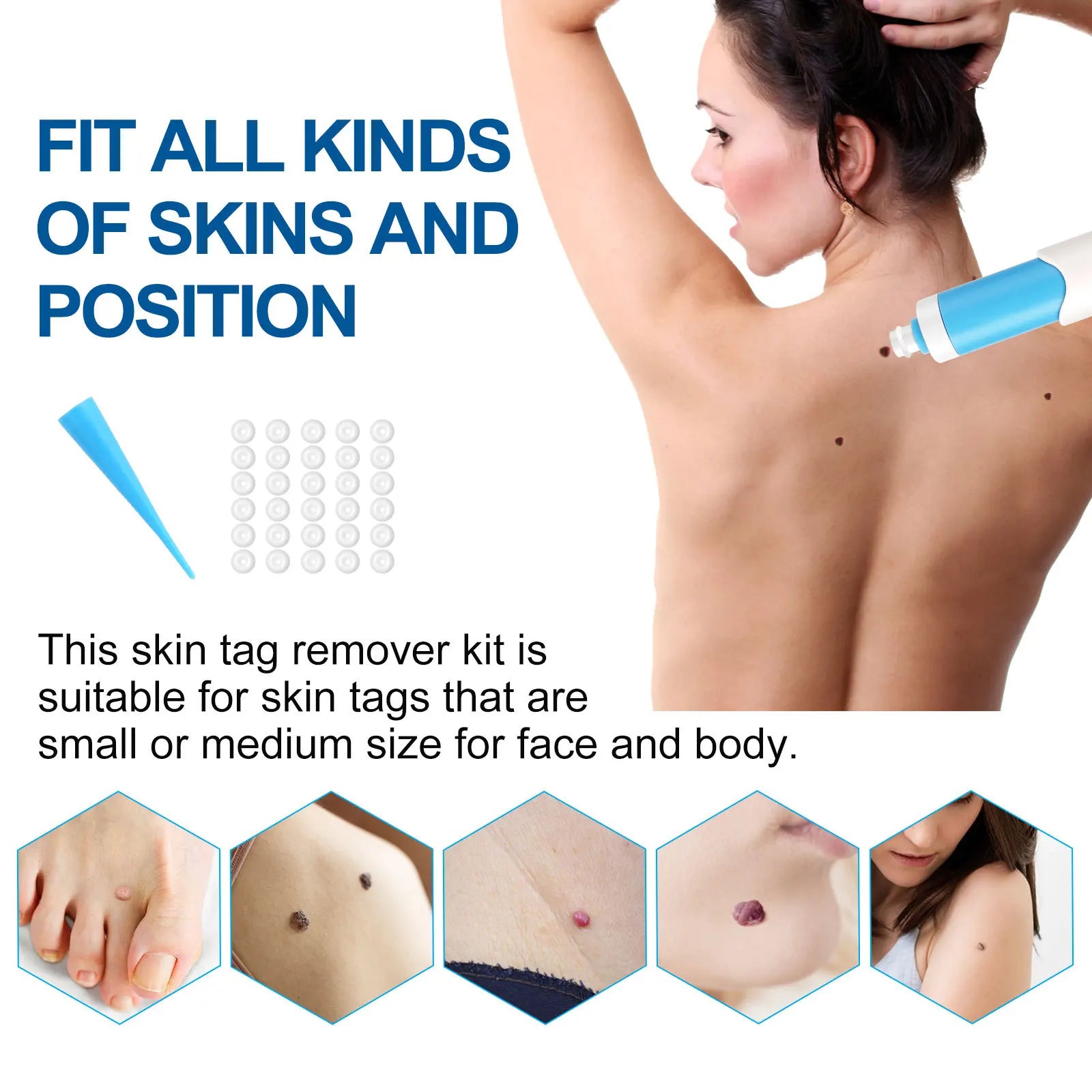 Skin Tag Remover 1-4mm Painless Safe Home Use Face Skin Care