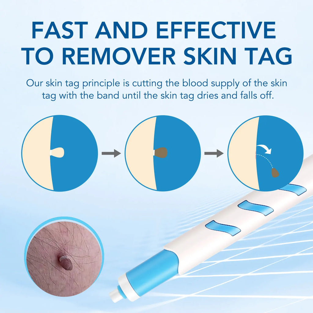 Skin Tag Remover 1-4mm Painless Safe Home Use Face Skin Care