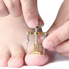 Ingrown Toenail Corrector Clip Onyxis Care