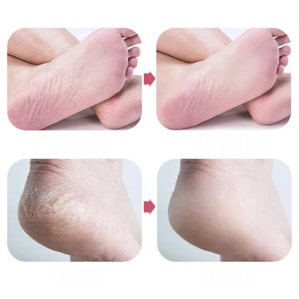Pedicure Foot File & Heel Polisher