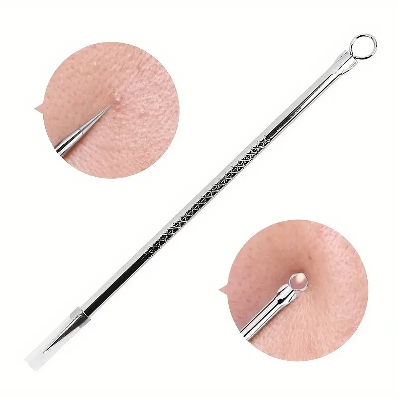 Stainless Steel Blackhead Remover Tool – Acne Pore Extractor Needle Main image