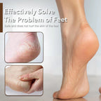 Professional Foot File Rasp Hard Skin & Callus Remover UK