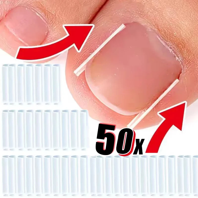 Ingrown Toenail Correction Tool Foot Care