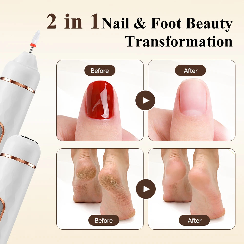 2-in-1 Electric Nail Foot File Callus Remover Replaceable Heads Tool