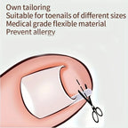 Ingrown Toenail Correction Tool Foot Care