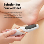 Electric Foot Callus Remover – Automatic Pedicure Grinder