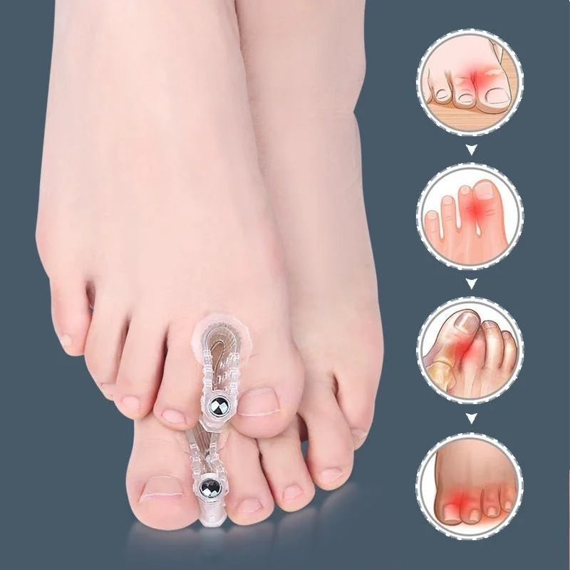 Bunion Corrector Toe Separator Support