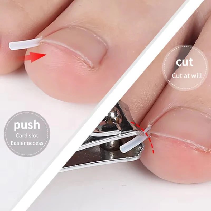 Ingrown Toenail Correction Tool Foot Care