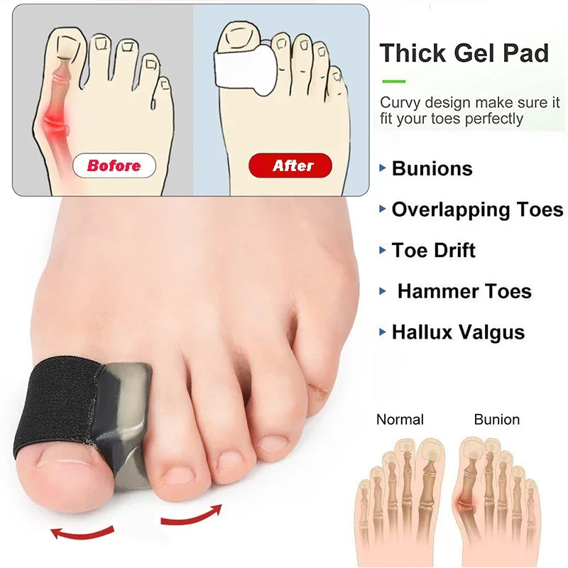 Gel Toe Separators Silicone Bunion Corrector