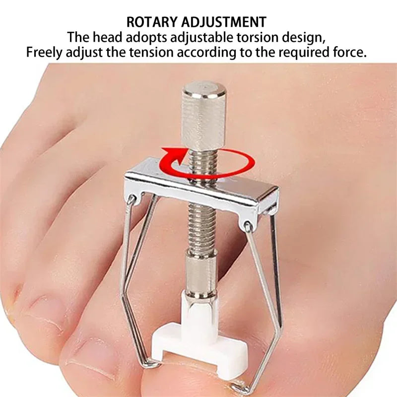 Ingrown Toenail Corrector Clip Onyxis Care