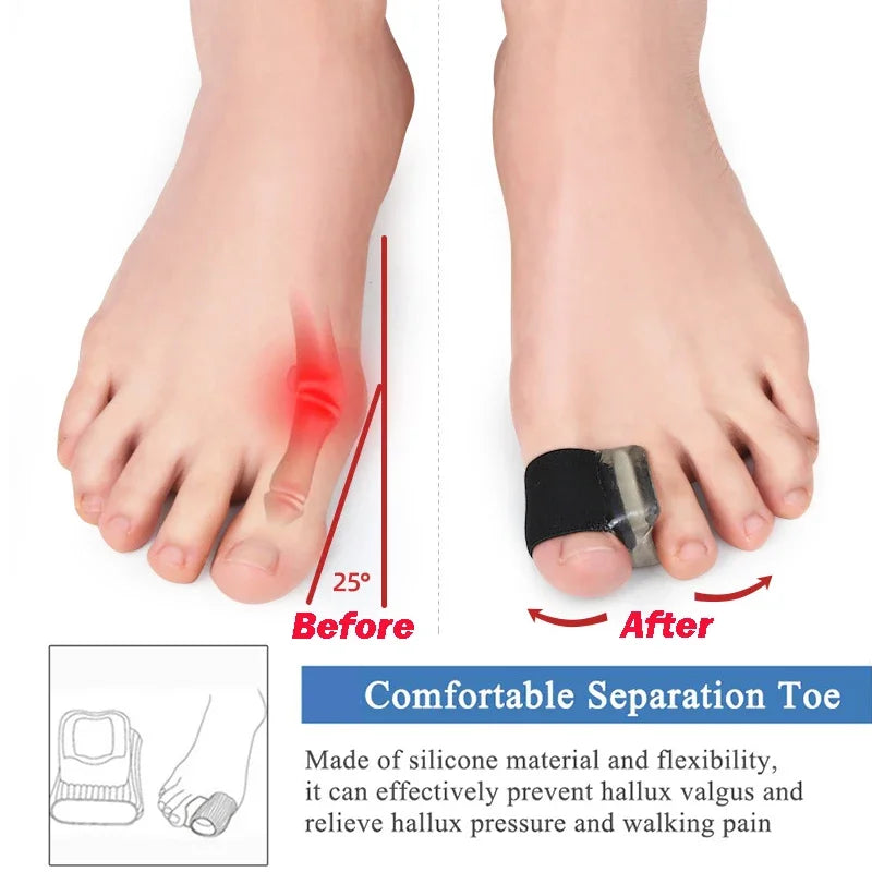 Gel Toe Separators Silicone Bunion Corrector