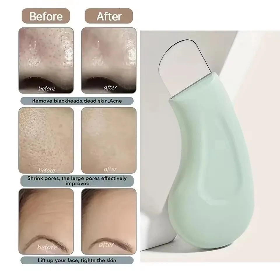 Nose Face Blackhead Whitehead Removal Tool Deep Pore Cleaner
