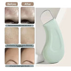 Nose Face Blackhead Whitehead Removal Tool Deep Pore Cleaner