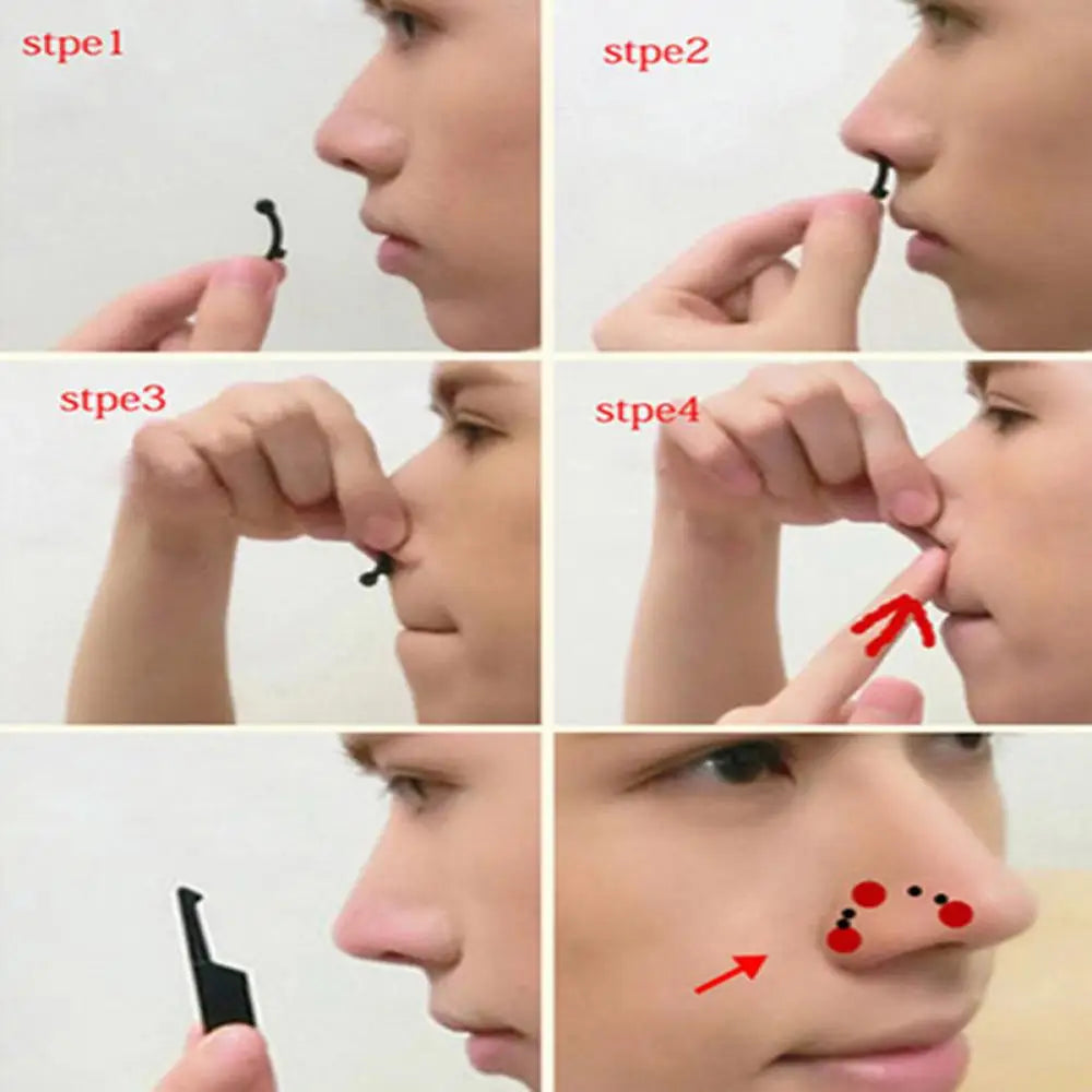 Nose Up Lifting & Shaping Clip Set - Pain-Free Bridge Straightener