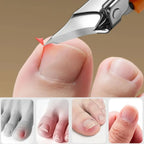 Ingrown Toenail Clipper 25° Slant Eagle Beak Wide Opening Steel Tool