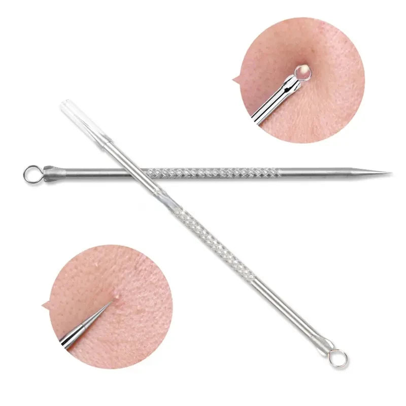 Stainless Steel Blackhead Remover Tool – Acne Pore Extractor Needle
