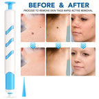 Skin Tag Remover 1-4mm Painless Safe Home Use Face Skin Care