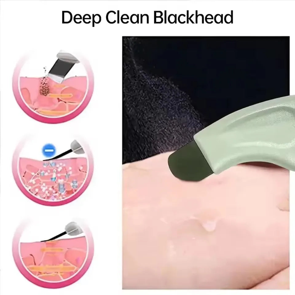 Nose Face Blackhead Whitehead Removal Tool Deep Pore Cleaner