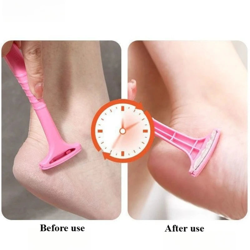 Pro Foot Scraper Callus Remover Tool
