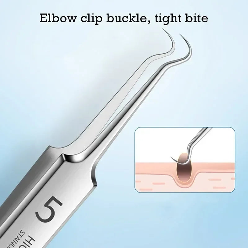 blackhead clip tweezers extracting facial pimple and nose blackhead for safe deep pore cleaning