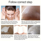 Blackhead Nose Patch before and after skin comparison for visibly shrinking pores and restoring complexion
