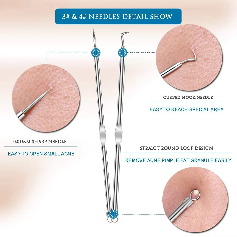 blackhead remover acne needle tools 4-piece set for extracting stubborn blackhead from nose for clear skin