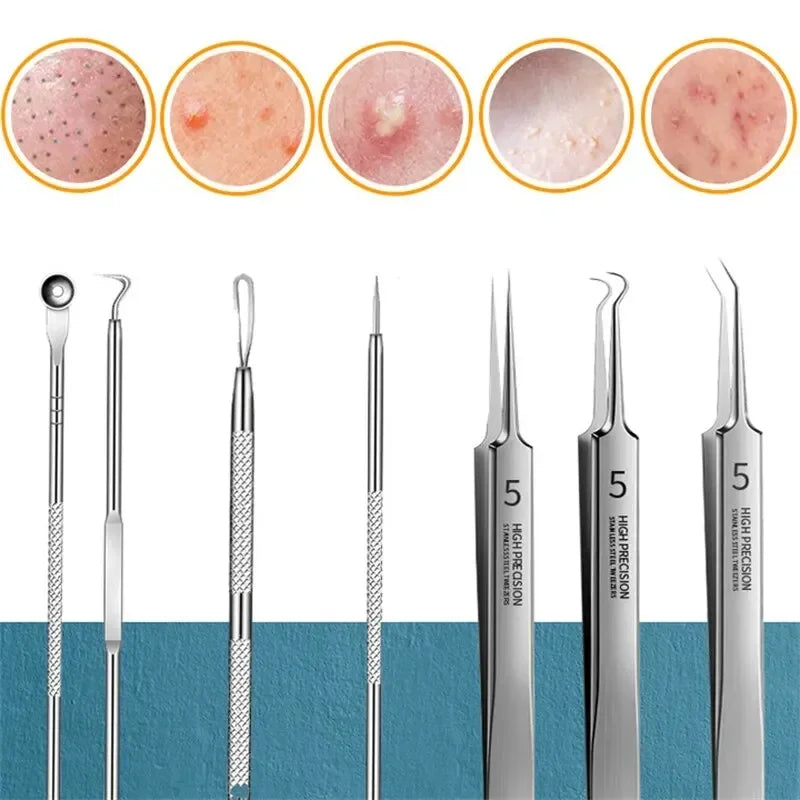 blackhead remover kit tool diagram showing precision loops and clips for nose pore cleaning and acne popping