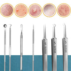 blackhead remover kit tool diagram showing precision loops and clips for nose pore cleaning and acne popping