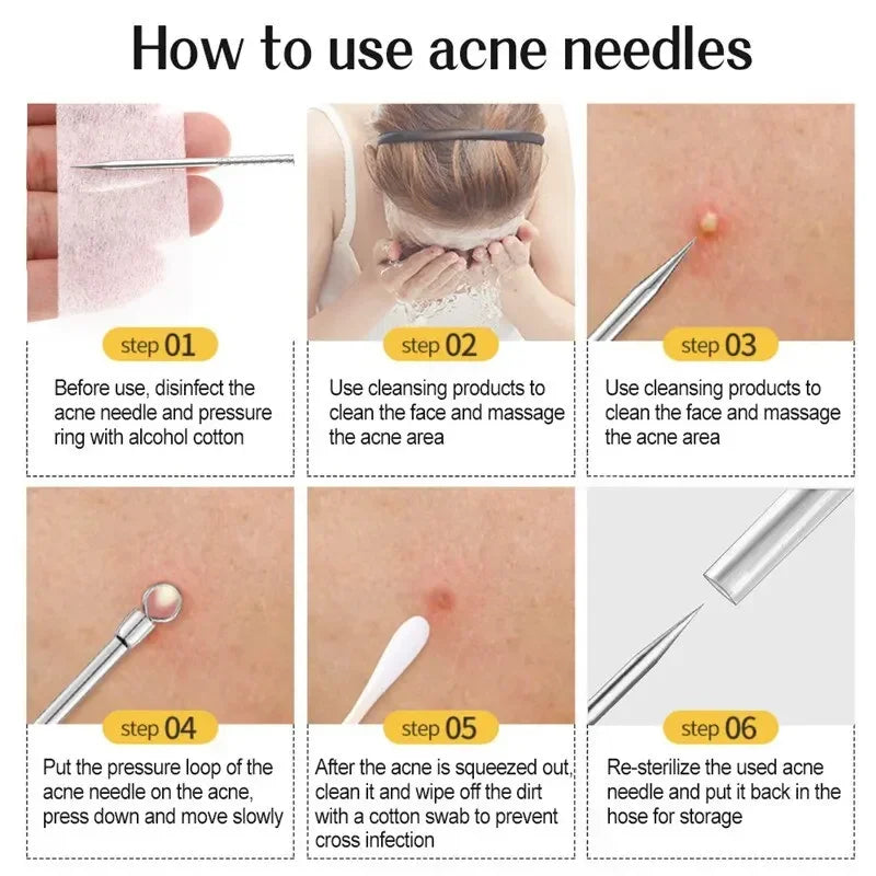 how to use blackhead remover kit step by step for safe nose acne extraction and blemish popping