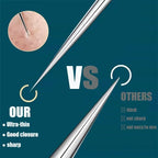 blackhead remover kit hygienic nose extraction compared to finger squeezing for safe acne treatment