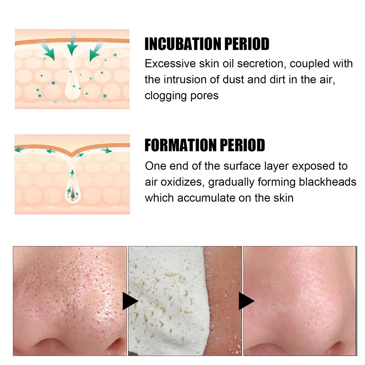 Blackhead Remover Nose Patches Deep Clean & Pore Minimizing 10-15PCS Secondary image