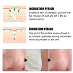 Blackhead Remover Nose Patches skin layer absorption diagram showing gentle dirt and oil extraction.